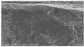 圖11-154 斷面A1、A2區邊沿微觀形貌